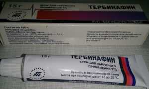 Лечение стригущего лишая: начните с мазей, завершите таблетками